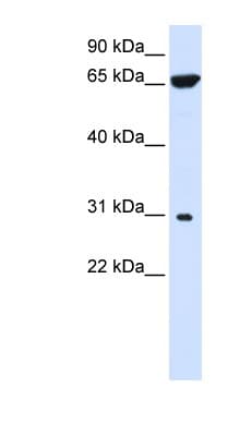 Polyclonal Rabbit anti-Human HACD4 / PTPLAD2 Antibody (aa72-121, WB)