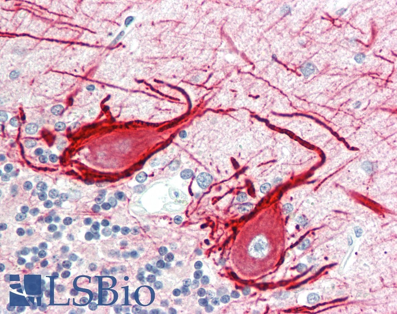 IHC-plus™ INA / Alpha Internexin Antibody (clone 2E3)