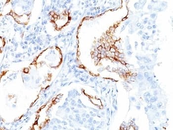 KRT7 / CK7 / Cytokeratin 7 Antibody (clone K72.7)