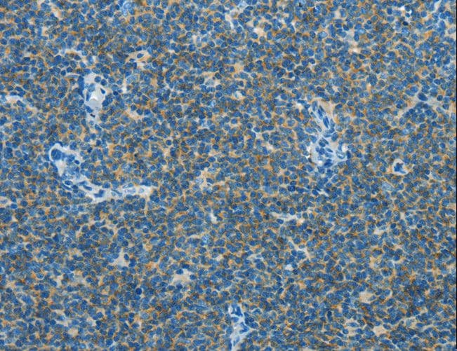 Polyclonal Rabbit anti-Human CAV3 / Caveolin 3 Antibody (IHC, WB)