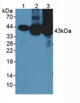 CKM / Creatine Kinase MM Antibody (aa11-367)