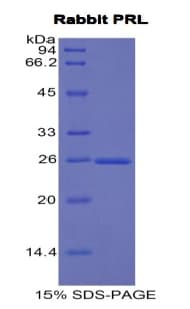 Rabbit PRL / Prolactin Protein (Recombinant His, N-Terminal)