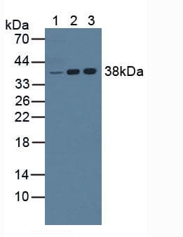 NPM1 / NPM / Nucleophosmin Antibody (aa212-292)