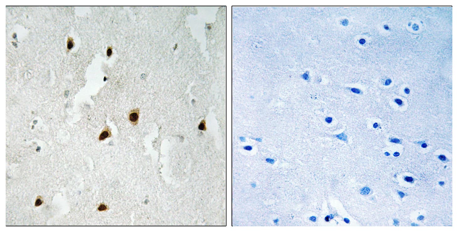 FOXO4 / AFX1 Antibody (phospho-Ser262)