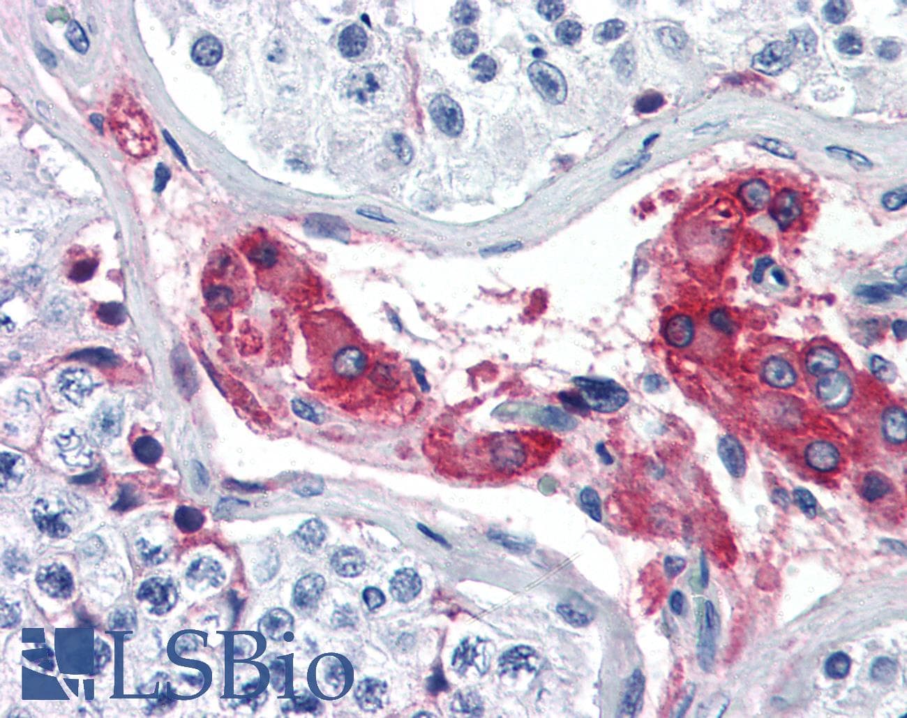 IHC-plus™ F12 / Factor XII Antibody