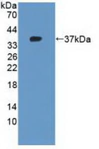 KRT10 / CK10 / Cytokeratin 10 Antibody (aa153-456, Cy3)