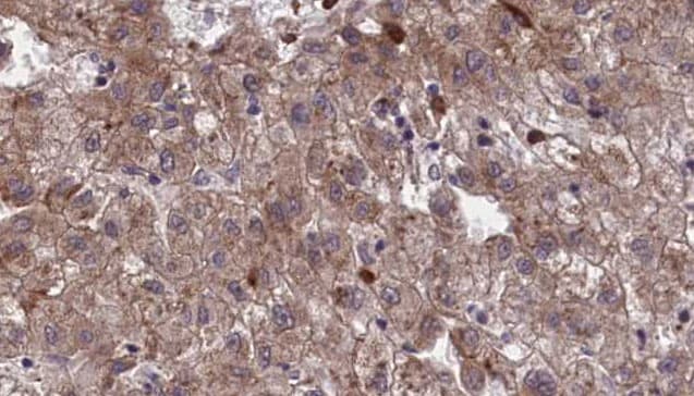 OR1I1 Antibody