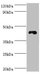 Polyclonal Rabbit anti-Human DRD3 / Dopamine Receptor D3 Antibody (aa213-329, IHC, WB)