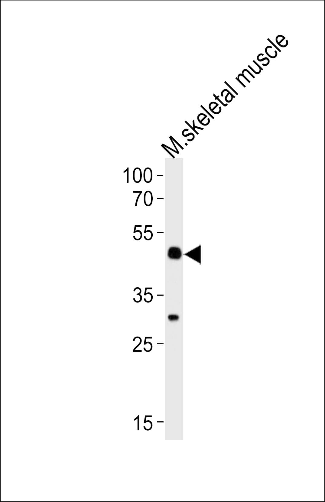 Polyclonal Rabbit anti-Mouse HOXC10 Antibody (aa217-246, IHC, WB)