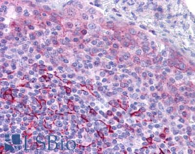 IHC-plus™ Polyclonal Rabbit anti-Human GPR171 Antibody (Extracellular Domain, IHC)