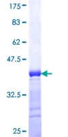 Human PKG / PRKG1 Protein (Recombinant GST, N-terminus)