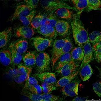 NFKB2 Antibody (phospho-Ser866)