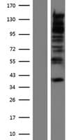 RBM27 Protein (Over-Expression Lysate Myc-DDK (Flag))