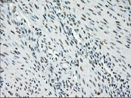 Monoclonal Mouse anti-Human BRAF / B-Raf Antibody (clone OTI4G6, IHC, WB)