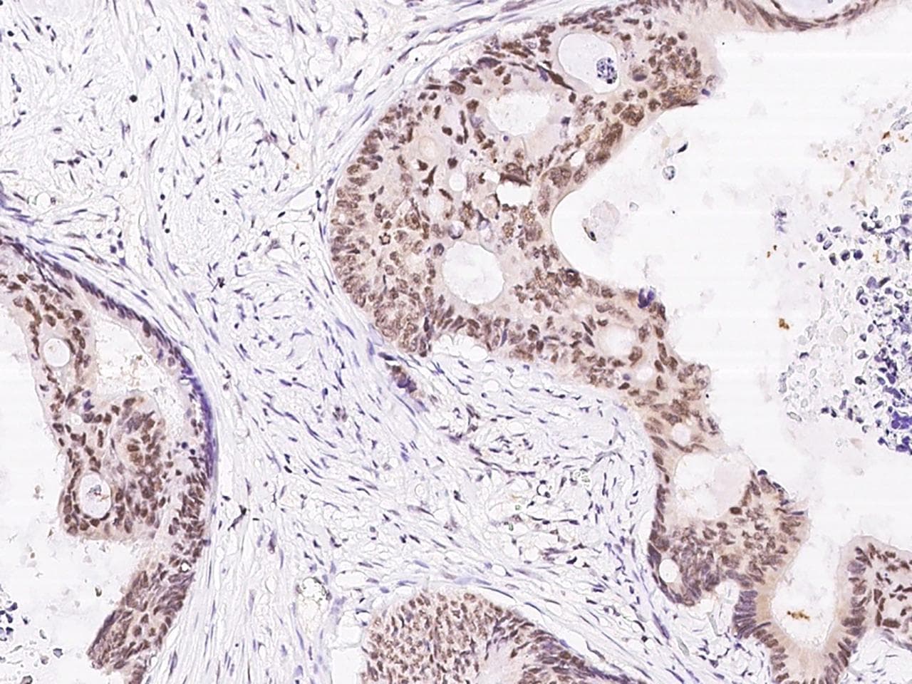 FOXK1 / MNF Antibody