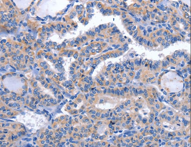 CCR6 Antibody