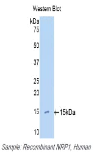 NRP1 / Neuropilin 1 Antibody (aa27-143)