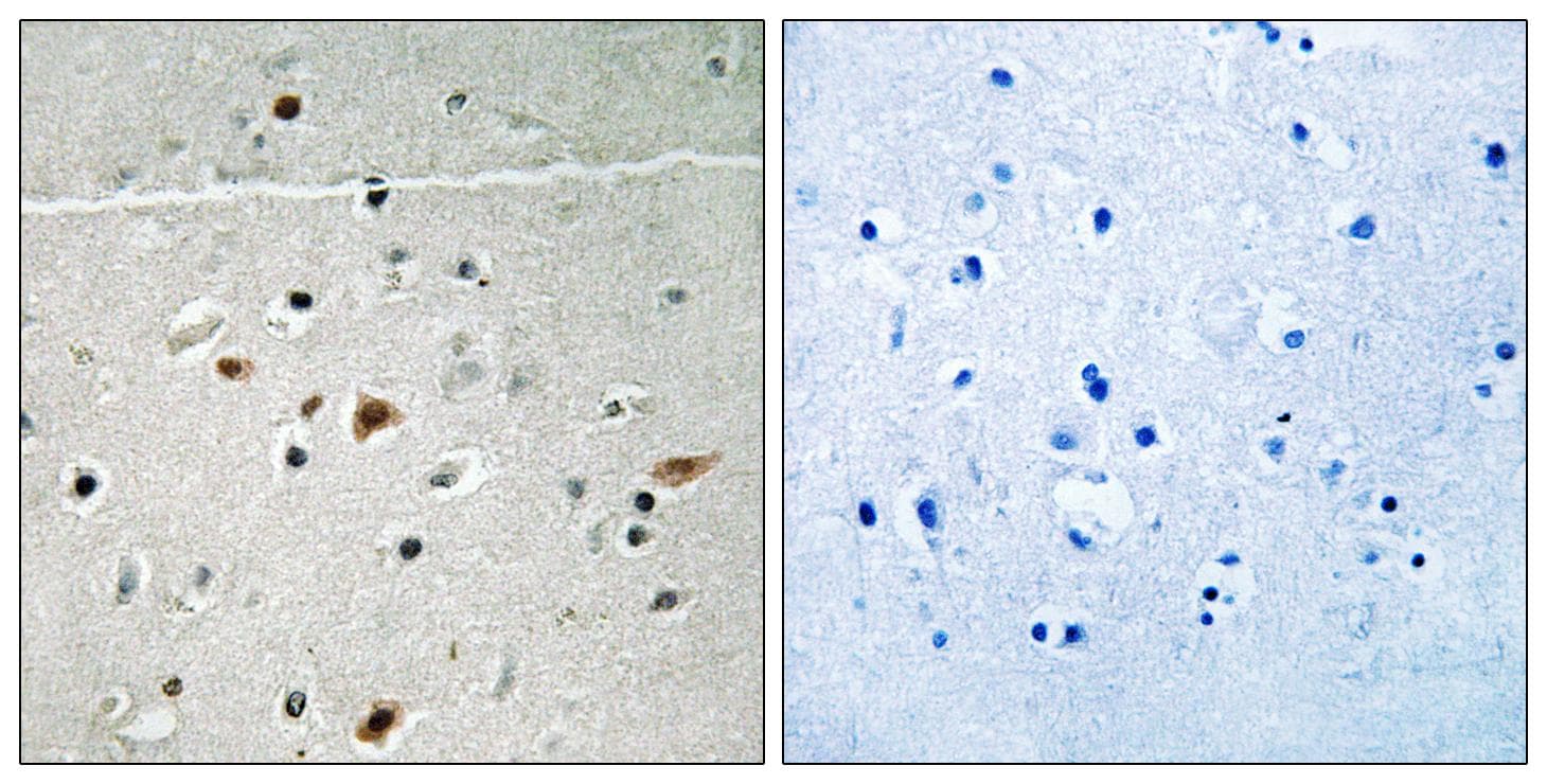 Polyclonal Rabbit anti-Human LIMK2 Antibody (phospho-Ser283, IHC)