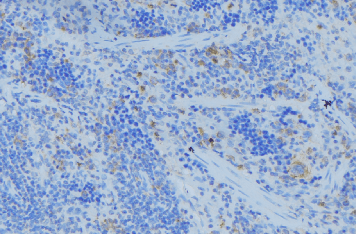 Polyclonal Rabbit anti-Human KRT77 / Keratin 77 / KRT1B Antibody (IHC, WB)