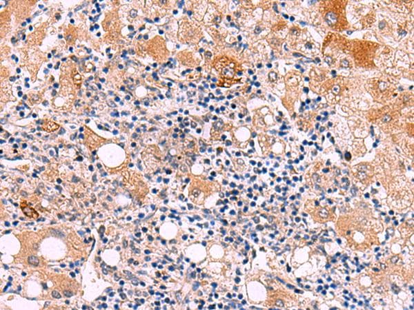 KATNAL1 Antibody