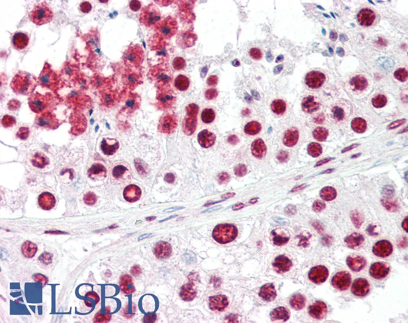 PathPlus™ Polyclonal Rabbit anti-Human ACIN1 / Acinus Antibody (IHC, IF, WB)