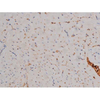 SYN / FYN Antibody (phospho-Tyr530)