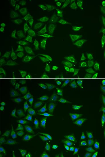 ST3GAL4 / ST3Gal IV Antibody