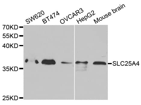 Polyclonal Rabbit anti-Human SLC25A4 / ANT Antibody (IHC, WB)