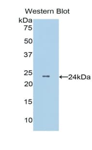 COMT Antibody (aa63-264, PE)