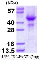Human HOMER2 / Homer 2 Protein (Recombinant His)