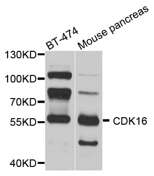 CDK16 / PCTAIRE Antibody