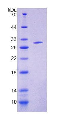 Rat TAP2 Protein (Recombinant His-T7, N-terminus)