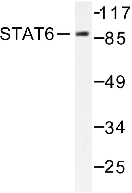 Polyclonal Rabbit anti-Human STAT6 Antibody (Arg639, IHC, WB)