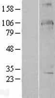 DDX24 Protein (Over-Expression Lysate Myc-DDK (Flag))