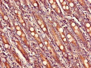 Polyclonal Rabbit anti-Human USHBP1 Antibody