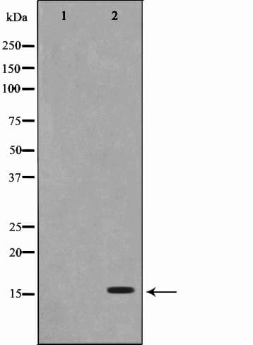 PFDN1 Antibody