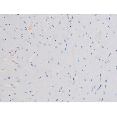 STAT3 Antibody (phospho-Ser727)