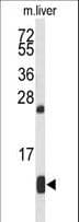 IHC-plus™ HBA1+2 / Hemoglobin Alpha Antibody (aa100-128)