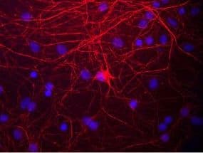 NEFM / NF-M Antibody