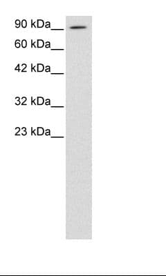 ACLP / AEBP1 Antibody (aa85-134)