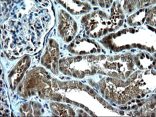 ZFAND3 / TEX27 Antibody (clone OTI1C5)
