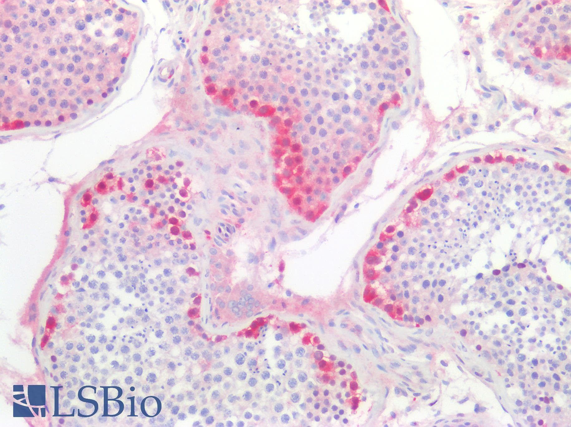 PathPlus™ Polyclonal Rabbit anti-Human ENO2 / NSE Antibody (IHC, WB)