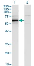 HCK Antibody (clone 1D9-1A9)