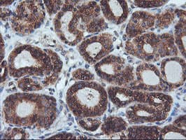 ILVBL Antibody (clone OTI8B12)