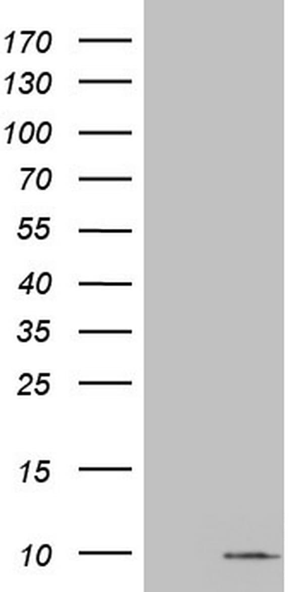 S100A6 / Calcyclin Antibody (clone OTI5A10)