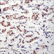STAT5A Antibody