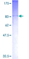 Human ASB2 Protein (Recombinant GST)