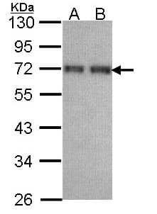CCDC6 Antibody