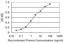 CHIT1 / Chitotriosidase Antibody (clone 1D11)