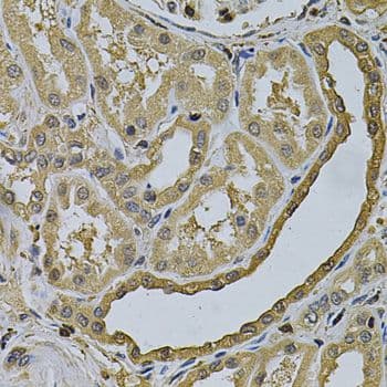LCP1 / L-Plastin Antibody